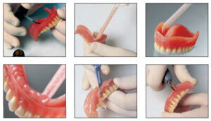 Ремонт и строительство | Восстановление зубов: подходы и этапы протезирования